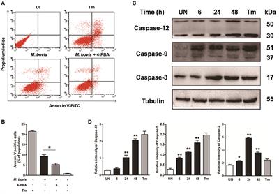 Mycobacterium bovis Induces Endoplasmic Reticulum Stress Mediated-Apoptosis by Activating IRF3 in a Murine Macrophage Cell Line